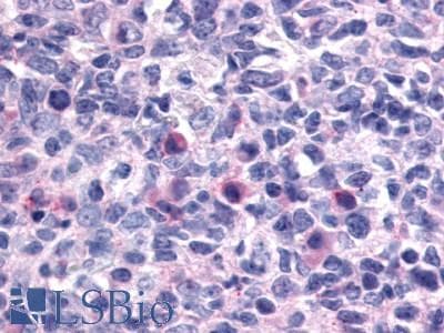 IHC-plus™ CXCR1 Antibody (N-Terminus)