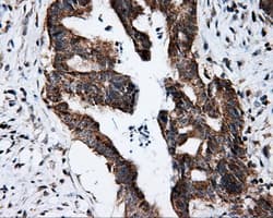 FKBP1A / FKBP12 Antibody (clone OTI3B3)