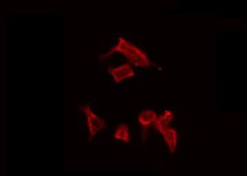 Polyclonal Rabbit anti-Human SOS2 Antibody (IF, WB)