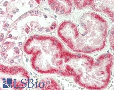 IHC-plus™ Polyclonal Rabbit anti-Human GT335 / ES1 Antibody (aa43-268, IHC, WB)