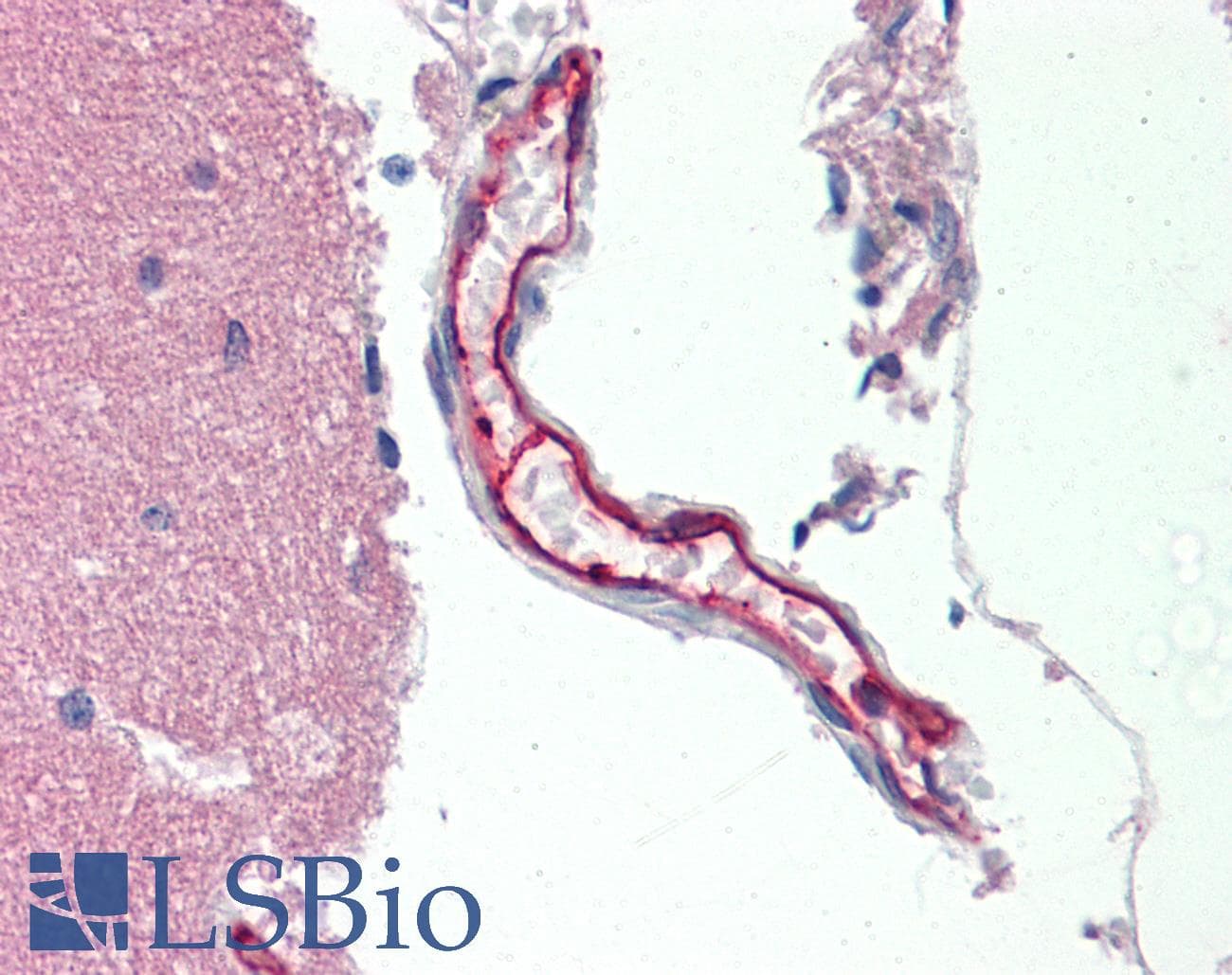 ABCB1 / MDR1 / P Glycoprotein Antibody (aa995-1280, clone 6H2, Carrier-free)