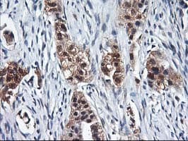 ALS2CR1 / NIF3L1 Antibody (clone OTI4B5)