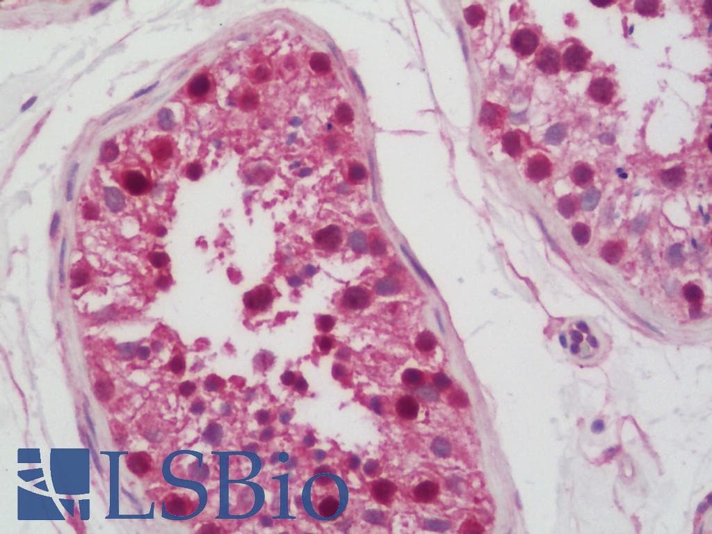 IHC-plus™ FAM175A / CCDC98 Antibody (aa350-400)
