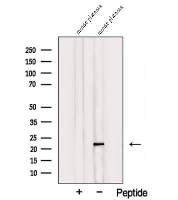 TMEM11 Antibody