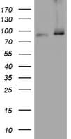 NBN / Nibrin Antibody (clone OTI3G3)