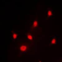 Polyclonal Rabbit anti-Human HNRNPL / hnRNP L Antibody (Internal, IHC, IF, WB)