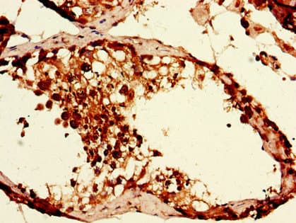 CAPZA1 / CAPZ Alpha 1 Antibody