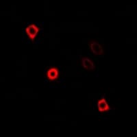 Polyclonal Rabbit anti-Human KIF3A Antibody (IHC, IF, WB)