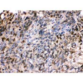 HSPA2 Antibody (aa564-598)