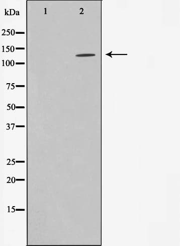 HDAC5 Antibody