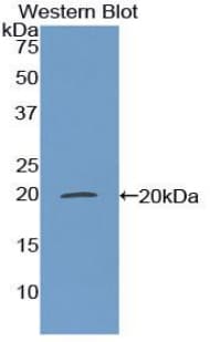 MGP / Matrix Gla-Protein Antibody (aa20-104, FITC)