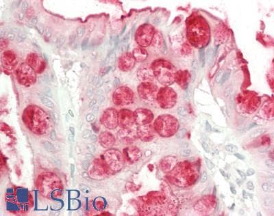 PathPlus™ TFF3 / Trefoil Factor 3 Antibody