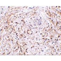ADGRA2 / GPR124 Antibody