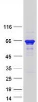 Human TSPYL1 Protein (Recombinant Myc-DDK (Flag))