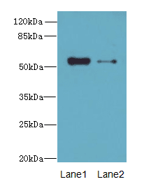 Polyclonal Rabbit anti-Human LACE1 Antibody (IHC, WB)
