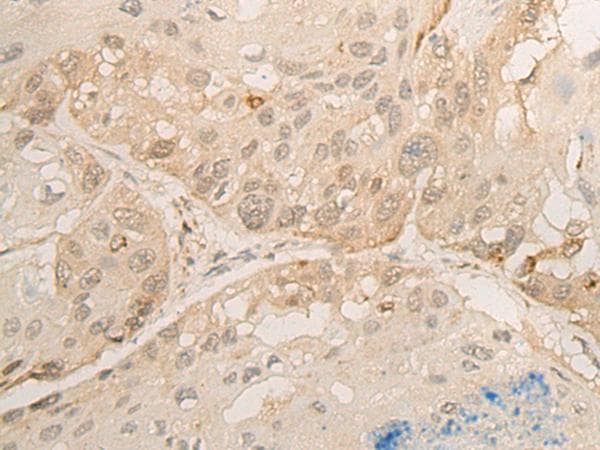 Polyclonal Rabbit anti-Human DROSHA / RNASEN Antibody (IHC)