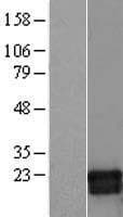 GMF Beta / GMFB Protein (Over-Expression Lysate Myc-DDK (Flag))