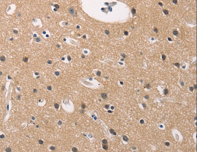 ADGRB1 / BAI1 Antibody