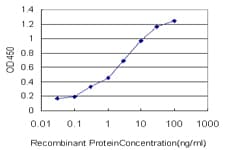 MVD Antibody (clone 2A7)