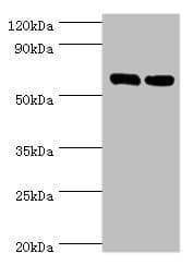 TROVE2 Antibody