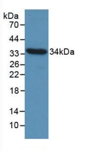 CCND1 / Cyclin D1 Antibody (aa1-292)