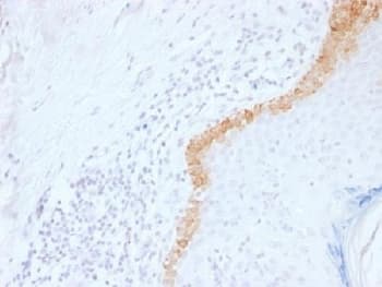 KRT15 / CK15 / Cytokeratin 15 Antibody (clone LHK15)