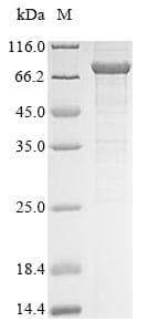 Human CT26 / DDX53 Protein (Recombinant 10His, N-terminus + Myc, C-terminus)