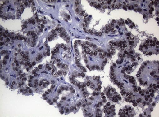 Monoclonal Mouse anti-Human SF1 Antibody (clone OTI7H9, aa1-276, IHC, WB)