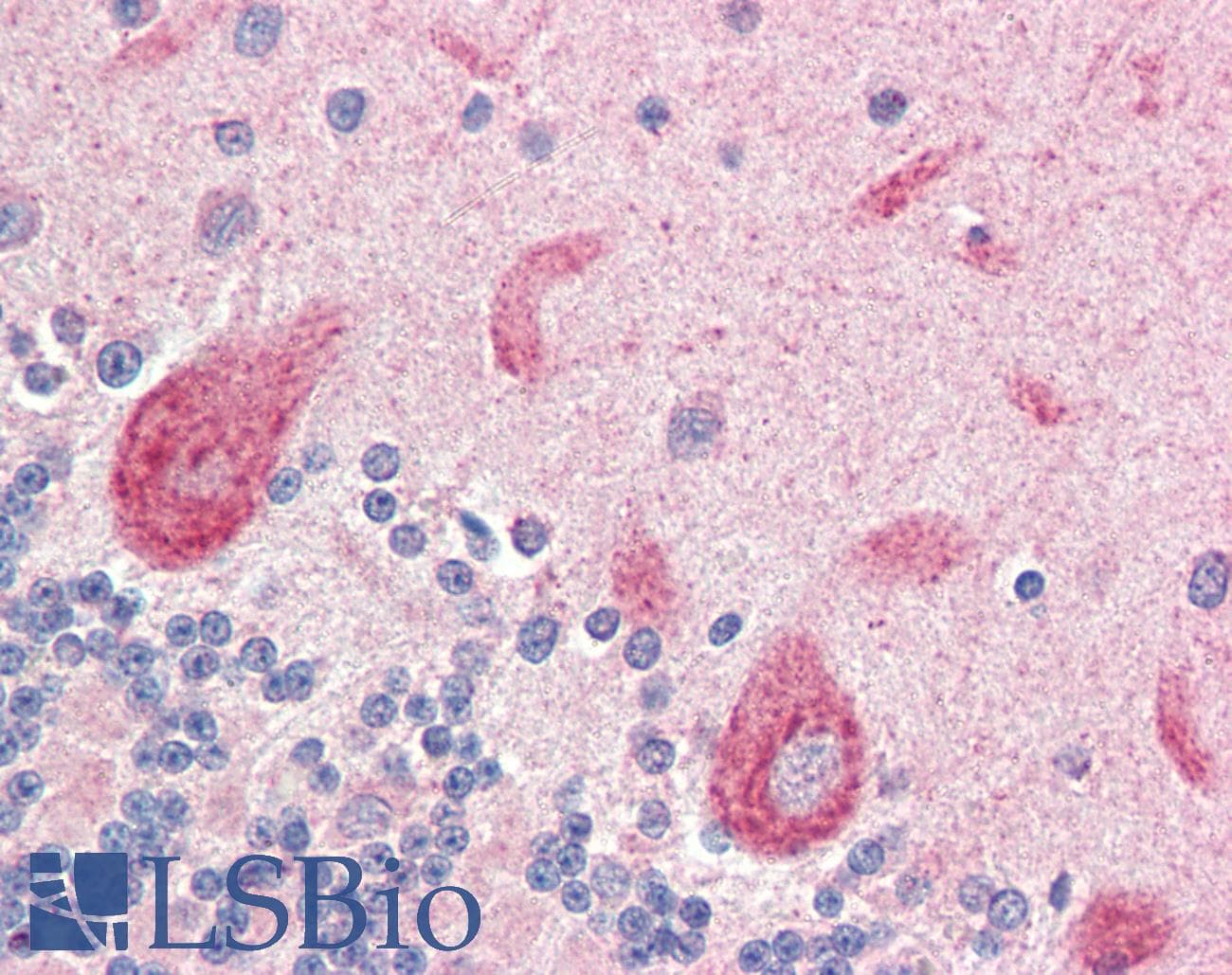IHC-plus™ LGI4 Antibody