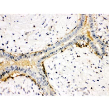 ACTA1 / Skeletal Muscle Actin Antibody (aa359-377)