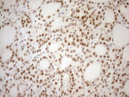 MGMT Antibody (clone OTI6C4, Carrier-free)