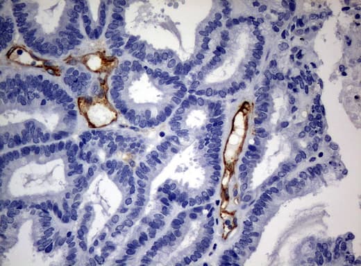 PECAM-1 / CD31 Antibody (clone UMAB31, Carrier-free)