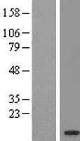 Human OSTC Protein (Over-Expression Lysate Myc-DDK (Flag))