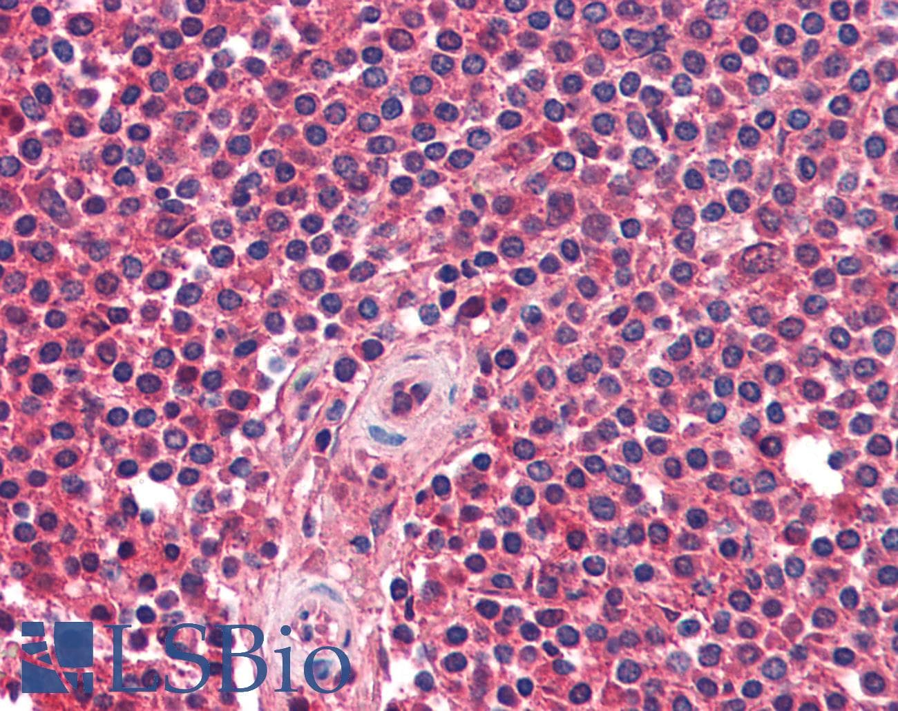 IHC-plus™ Polyclonal Rabbit anti-Human CXCR5 Antibody (IHC, WB)