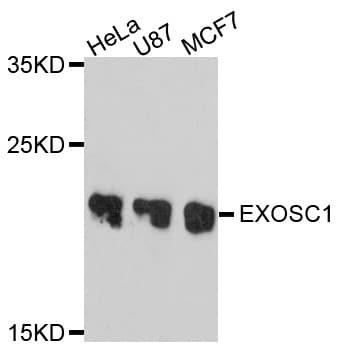 Polyclonal Rabbit anti-Human EXOSC1 / CSL4 Antibody (WB)
