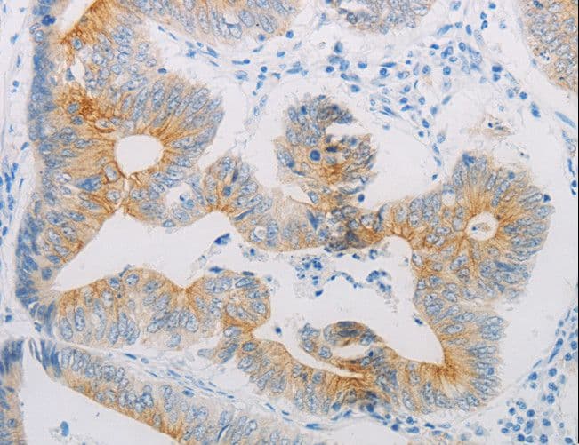 Polyclonal Rabbit anti-Human ADRB2 Antibody (IHC, WB)