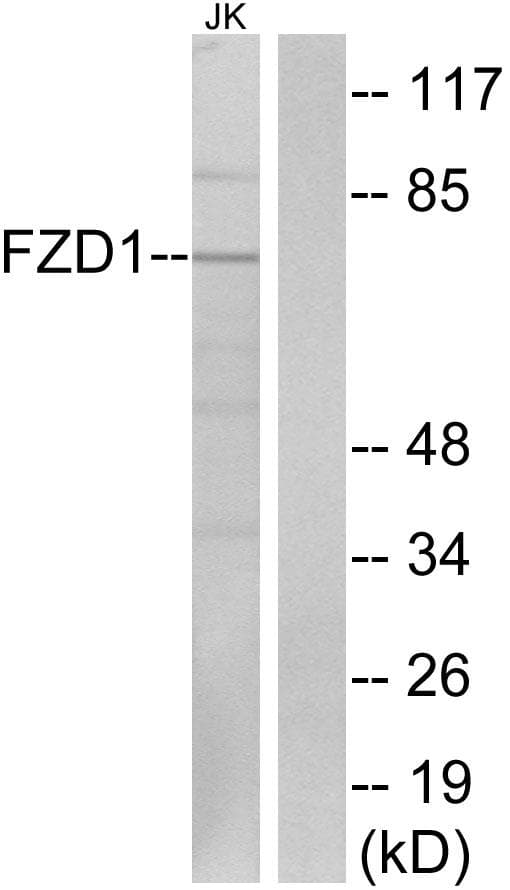 Polyclonal Rabbit anti-Human FZD1 / Frizzled 1 Antibody (WB)