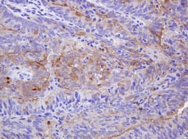 ABCB1 / MDR1 / P Glycoprotein Antibody (aa995-1280, clone OTI2G6, Carrier-free)