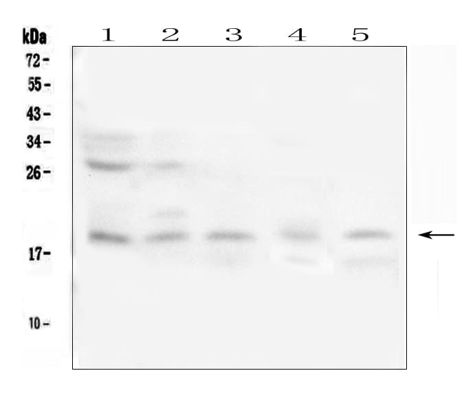 IFN Gamma / Interferon Gamma Antibody