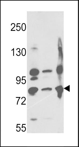 Polyclonal Rabbit anti-Human MME / CD10 Antibody (aa506-534, IHC, WB)