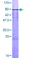 Human CASQ1 / Calsequestrin 1 Protein (Recombinant GST)