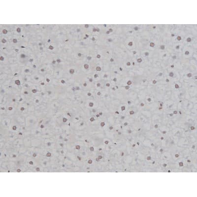 Polyclonal Rabbit anti-Human CHUK / IKKA / IKK Alpha Antibody (phospho-Ser180,phospho-Ser181, IHC, IF, WB)