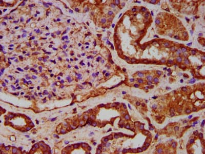 IKBKAP / IKAP Antibody