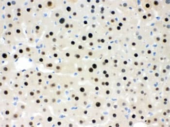RBBP4 / RBAP48 Antibody