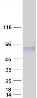 Human CLN5 Protein (Recombinant Myc-DDK (Flag))