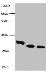 Monoclonal Mouse anti-Human RBP4 Antibody (WB)