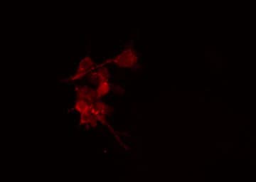 PRKACB Antibody