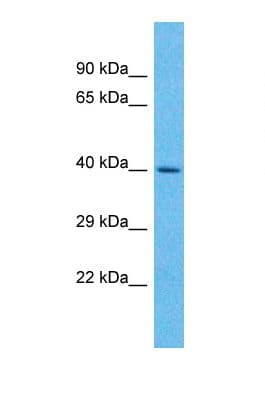 UCKL1 Antibody (N-Terminus)