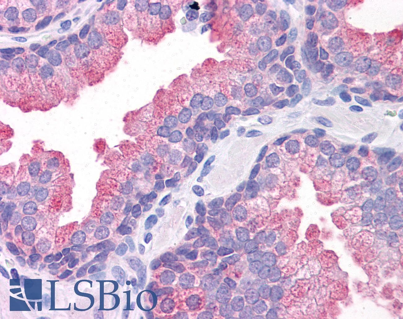 IHC-plus™ TMEM184A Antibody