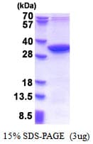 Human MMADHC / C2orf25 Protein (Recombinant His)
